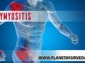 Polymyositis- Causes, Symptoms, Diagnosis Natural Treatment