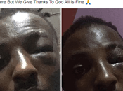 Girlfriend Mobilize Area Boys Beat Boyfriend Mistakenly Slapped [Photos]