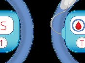 What Type Diabetes? Causes Symptoms Treatment