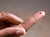 Ketone Measurements Same. Does Matter?