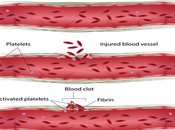 Treatment Afibrinogenemia Ayueveda