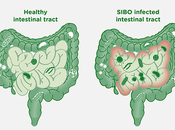 Treatment Small Intestinal Bacterial Overgrowth (SIBO) Through Ayurveda