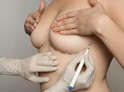 Questions Before Getting Breast Revision Surgery