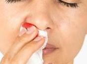 Epistaxis Ayurvedic Treatment