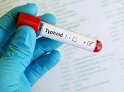 What Typhoid? Symptoms, Causes Ayurvedic Treatment