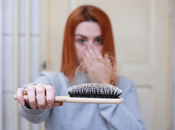 Relationship Between Stress Hair Loss