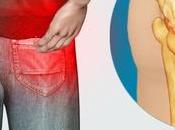 Sciatica Causes Diagnosis Herbal Treatment