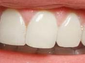 Dental Problems That Fixed Braces 2020