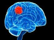 What Brain Tumor? Causes, Signs Ayurvedic Treatment Cure