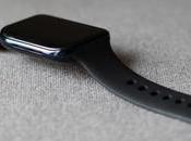 OnePlus Watch Been Development Last Year: Ex-employee