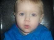 Bruised Collar Bone High Temperature; Just Another