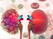 Herbal Remedies Autosomal Dominant Polycystic Kidney Disease (ADPKD)