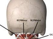 Common Causes Neck Pain Base Skull: Know Truth