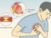 Home Remedies Angina