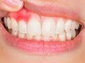 Home Remedies Disease