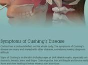 Cushing’s Disease: Symptoms, Causes Treatment