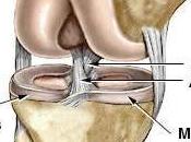 Regenexx Repair Reconstruction Surgery Knee