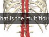 Multifidus Pain: Free Study Patients with Ongoing Back Pain