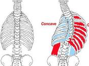 Degenerative Scoliosis? Exciting Non-surgical Treatment Option