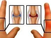 Ayurvedic Management Juvenile Arthritis