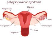 Pcod/pcos