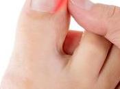 What Causes Ingrown Toenails? Tips Prevention Treatment