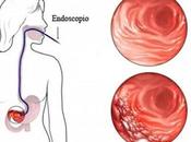 Chronic Gastritis Causes, Symptoms, Ayurvedic Treatment, Herbal Remedies, Diet Lifestyle
