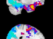 Watching Brain Regions That Help Anticipate What's Going Happen Next.