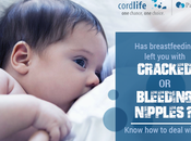 Breastfeeding Left with Cracked Bleeding Nipples? Know Deal