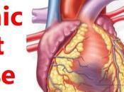 Ischemic Heart Disease Herbal Remedies Ayurvedic Treatment