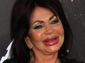 Jackie Stallone’s Lips: Women’s Mouths Getting