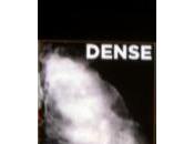 Mandatory Breast Density Notification