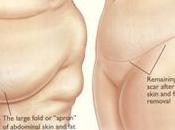 Body Contouring, Fertility Treatment re-Naming Countries