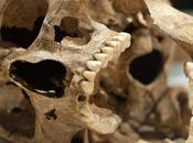 Want Great Teeth? Paleo