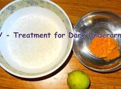 DIY- Treatment Dark Underarms
