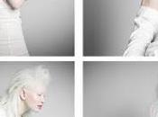 Whiter Shade Pale Albino Models Take Runways