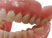 Kinds Dentures Will Discuss with Your Dentist When Start Lose Teeth