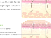 Importance Skin Exfoliation