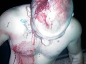 Marine Beaten, Stabbed 15-20 Blacks After Zimmerman Verdict