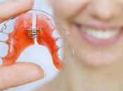 Clean Retainers: Tips Tricks That Work!