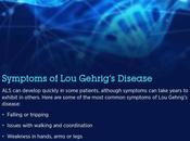 Gehrig’s Disease (ALS): Symptoms, Causes Treatment