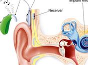 Cochlear Implant Experience