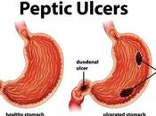 Duodenal Ulcers Special Ayurvedic Care Packages