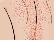 Thrombocytopenia Treatment Market Size, Share, Outlook, Opportunity Analysis 2018–2026