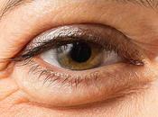 Puffy Eyes With Ayurveda!