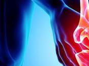 Total Knee Arthroplasty Market Global Analysis, Size, Share, Growth, Trends, Forecast, 2021 2028