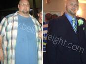 Brian’s Long Term Gastric Sleeve Success Story