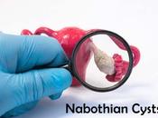 What Some Natural Remedies Treat Nabothian Cysts?