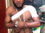 Police Officers Beat Hell Young Man, Break Hand After Accusing Being Yahoo (Photos)
