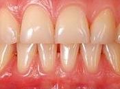 Periodontal Disease Therapeutics Market Size, Share, Trends, Business Development, Analysis Opportunities 2018 2026